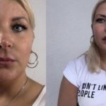 Lippen aufspritzen mit Hyaluron